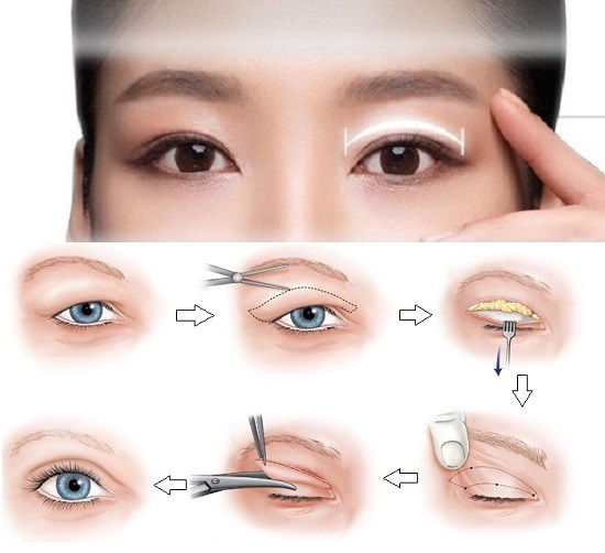 Sao cắt mí, người được khen đẹp như Phạm Băng Băng, người quyến rũ trông thấy - 20