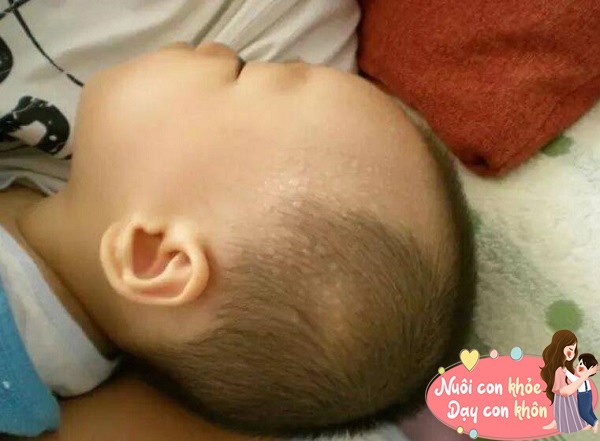 Trẻ đổ mồ hôi trộm khi ngủ, không phải do thiếu canxi, mẹ làm 3 điều này để bảo vệ - 6