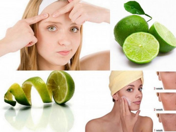 Cách trị mụn bằng chanh hiệu quả tận gốc và an toàn nhất