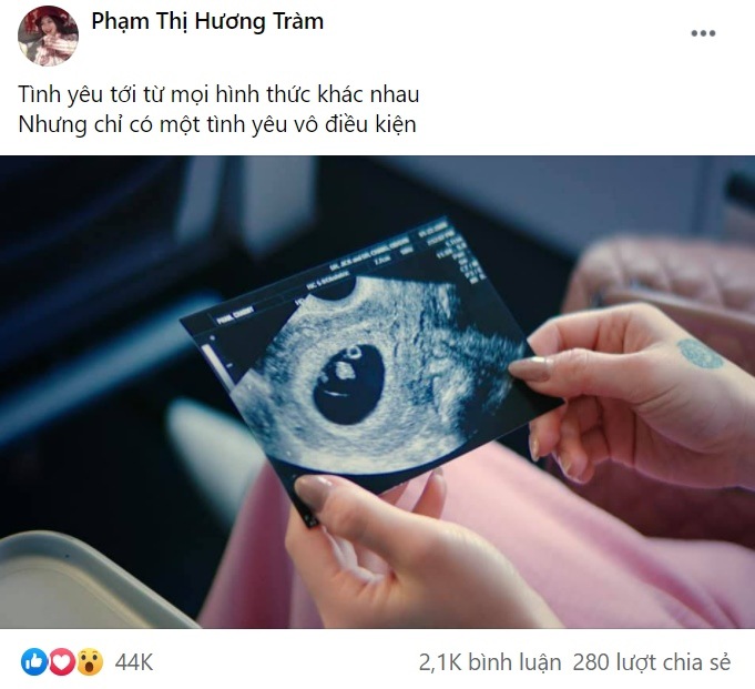 Khoe ảnh siêu âm thai nhi ở Mỹ, Hương Tràm bị nghi amp;#34;chiêu tròamp;#34; vì chia sẻ của Phương Thanh - 1