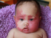 Bà bầu - Bà bầu đẻ con "mặt đỏ", mẹ chồng tức tối trách: "Tại không giữ cái miệng"