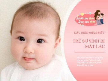 Tại sao trẻ sơ sinh bị lác mắt? Chuyên gia mách mẹ yếu tố nhận biết