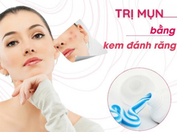 12 cách trị mụn thâm đơn giản an toàn hiệu quả nhanh nhất tại nhà