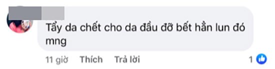 CĐM truyền tay nhau công thức trị tóc bết, nặng đô như đổ dầu nhớt cũng chữa được - 5