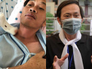 Giải trí - Một số điểm bất hợp lý về thông tin, hình ảnh điều trị u ác tuyến giáp của Hoài Linh