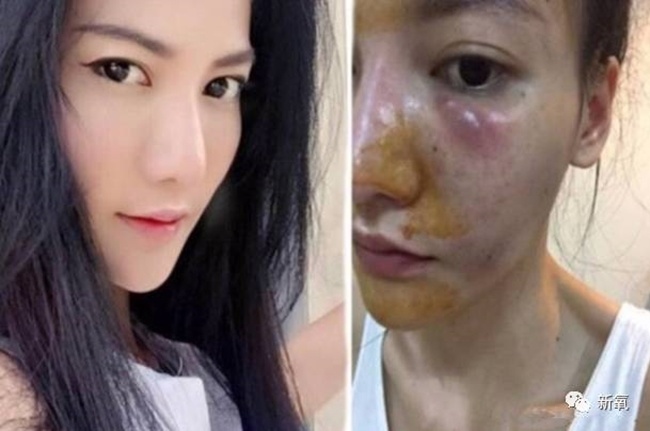 amp;#34;Em gáiamp;#34; Hồng Diễm công khai ảnh thời sinh viên: Khẳng định không dao kéo nhưng vẫn nhờ thủ thuật - 12