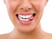 Sức khỏe - Thường xuyên cắn vào lưỡi quá nhiều có thể là dấu hiệu của đột quỵ, thậm chí ung thư