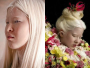 Tin tức - Bị bố mẹ bỏ rơi vì ngoại hình khác biệt, 16 năm sau cô gái làm nên kỳ tích