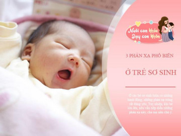 3 phản xạ của trẻ sơ sinh sẽ phải mất khi lớn, nếu cứ tiếp diễn, mẹ nên cẩn thận