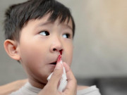 Trẻ chảy máu cam - ẩn chứa nhiều nguy hiểm không thể xem thường!