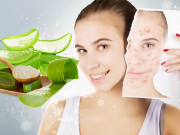 Làm đẹp - 8 Cách trị mụn bọc sưng đỏ an toàn hiệu quả không để lại vết thâm