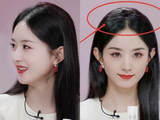 Ngôi sao 24/7: Triệu Lệ Dĩnh gặp vấn đề sức khỏe của bà đẻ, tình hình ngày càng nghiêm trọng