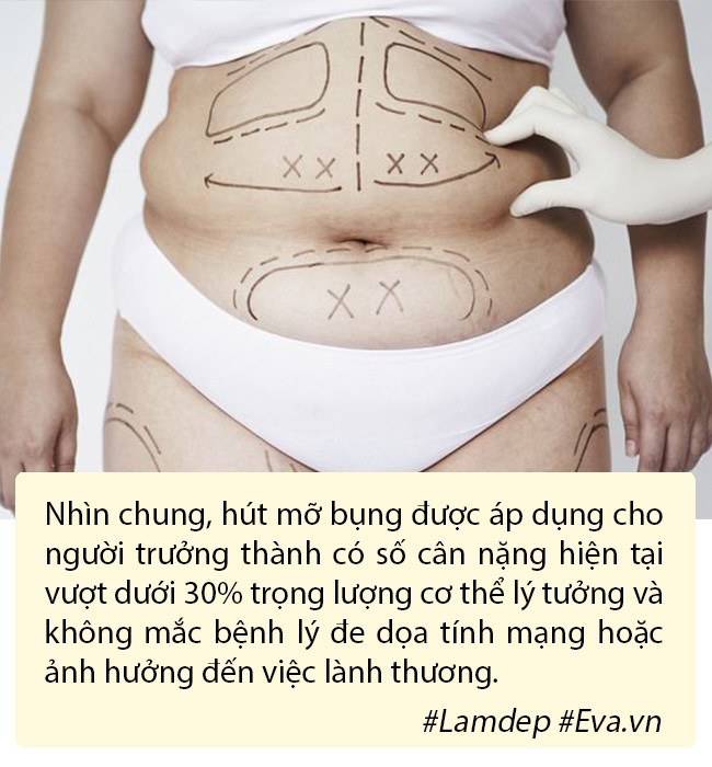 Hút mỡ tạo hình thành bụng có nguy hiểm không? - 3