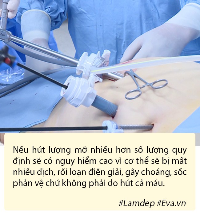 Hút mỡ tạo hình thành bụng có nguy hiểm không? - 4