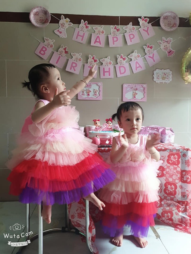 Cặp song sinh dính liền Trúc Nhi-Diệu Nhi tròn 2 tuổi: Hình ảnh hiện tại và ngày SN đặc biệt - 1