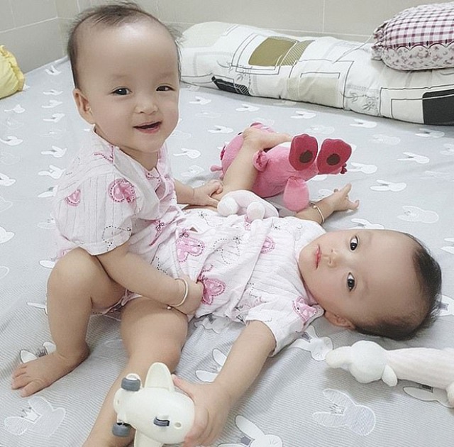 Cặp song sinh dính liền Trúc Nhi-Diệu Nhi tròn 2 tuổi: Hình ảnh hiện tại và ngày SN đặc biệt - 4