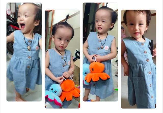 Cặp song sinh dính liền Trúc Nhi-Diệu Nhi tròn 2 tuổi: Hình ảnh hiện tại và ngày SN đặc biệt - 8