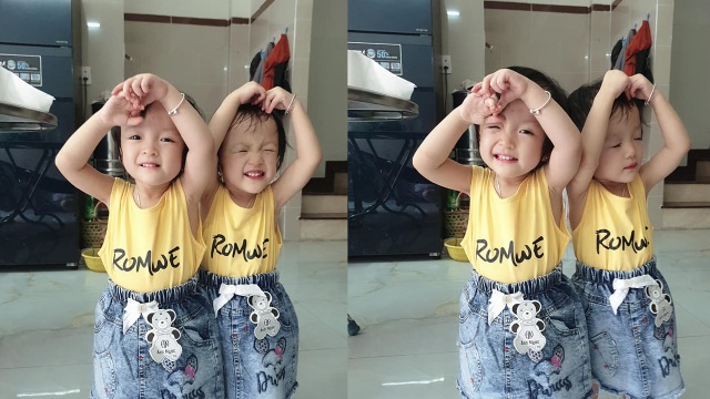 Cặp song sinh dính liền Trúc Nhi-Diệu Nhi tròn 2 tuổi: Hình ảnh hiện tại và ngày SN đặc biệt - 7