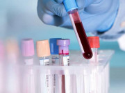 Tin tức - Nghi vợ ngoại tình vì không cùng nhóm máu với con, chồng sững sờ khi xét nghiệm ADN