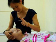 Bà bầu - Đi siêu âm bác sĩ khuyên bỏ, mẹ kiên quyết giữ con rồi đẻ ra đứa trẻ "hải cẩu"