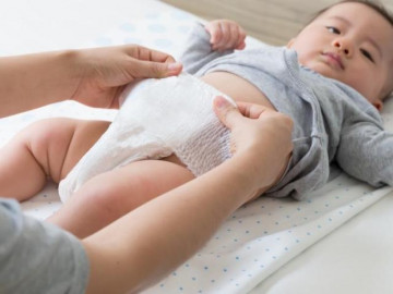 Mẹo chống hăm tã để mẹ vô tư đóng bỉm cho bé suốt mùa hè