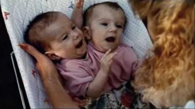 Cặp sinh đôi dính liền amp;#34;một thể xác, 2 linh hồnamp;#34;, mơ ước tìm được 2 chàng trai để yêu - 1