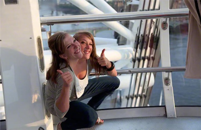 Cặp sinh đôi dính liền amp;#34;một thể xác, 2 linh hồnamp;#34;, mơ ước tìm được 2 chàng trai để yêu - 5