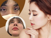 Dao kéo hỏng: cái khổ của bệnh nhân và cái khó của bác sĩ