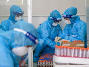 Sức khỏe - Tối 16/6: Thêm 155 ca mắc COVID-19, tổng trong ngày Việt Nam ghi nhận 423 trường hợp