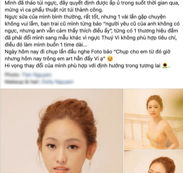 Nhiều sao nữ tháo túi độn ngực trở về với vẻ đẹp tự nhiên, nguyên nhân vì đâu? - 5
