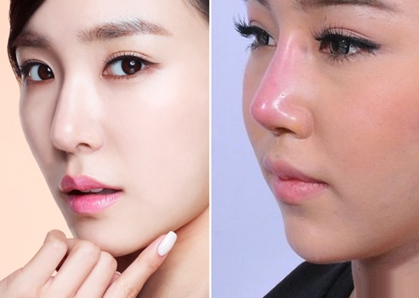 Quỳnh Hoa tự bóp mũi, chứng minh đẹp tự nhiên không phẫu thuật thẩm mỹ - 19