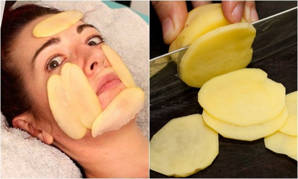 15 Cách làm mặt nạ khoai tây giúp dưỡng da trắng sáng mịn màng - 6