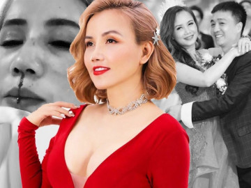 Nâng mũi chưa lâu đã gặp tai nạn, chị em gặp tình cảnh như cô Xuyến cần làm gì?