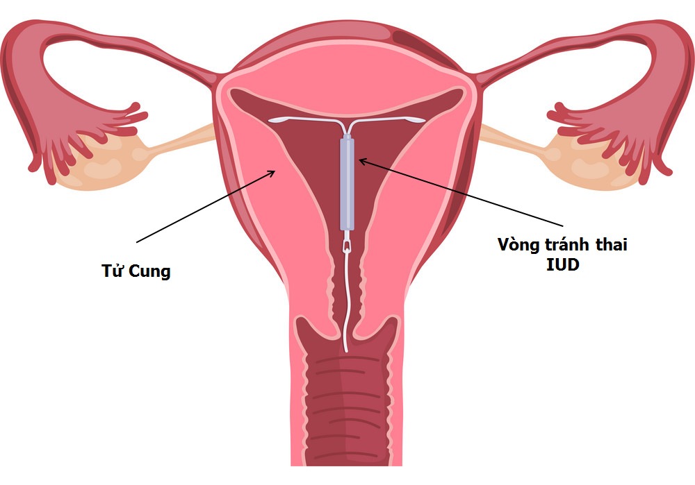 amp;#34;Công chúa nhạc Popamp;#34; đau khổ không được phép có thai vì bố ép mang một thứ trong người - 4