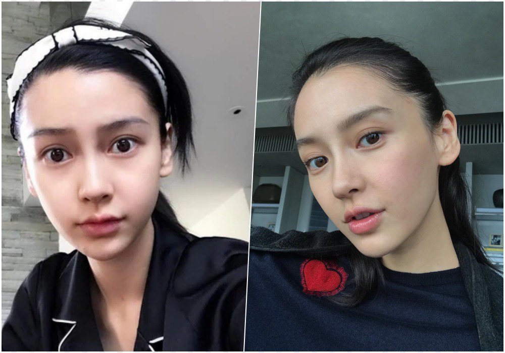 Angelababy thời thanh xuân mặt tròn phúng phính, giờ U35 gầy nhom lộ cả rổ khuyết điểm - 15