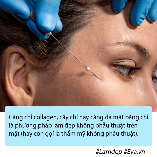 Bạn có đang nhầm lẫn về phương pháp căng chỉ collagen trẻ hóa da mặt? - 1