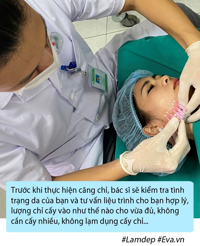 Bạn có đang nhầm lẫn về phương pháp căng chỉ collagen trẻ hóa da mặt? - 5