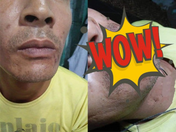 Ông bố chất chơi trốn vợ con đi phun xăm môi và cái kết bất ngờ