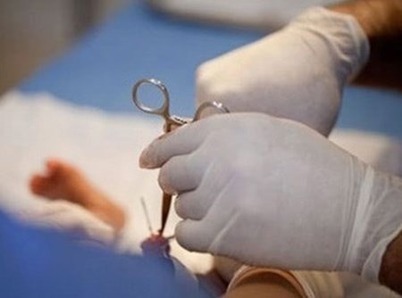 Không nên cắt bao quy đầu cho trẻ, tại sao? - 1