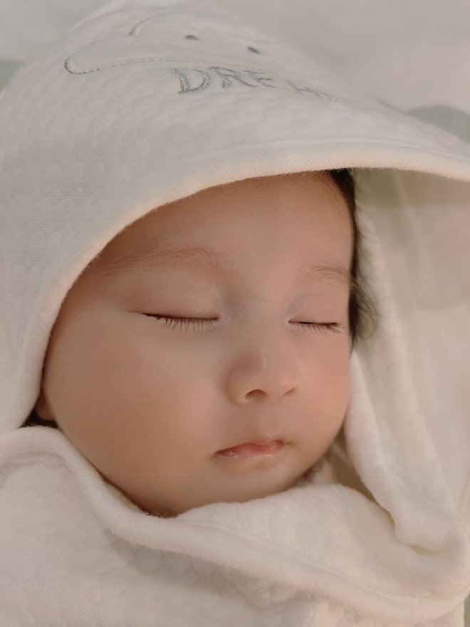 Cô bé có đôi má phúng phính và nước da trắng hồng.