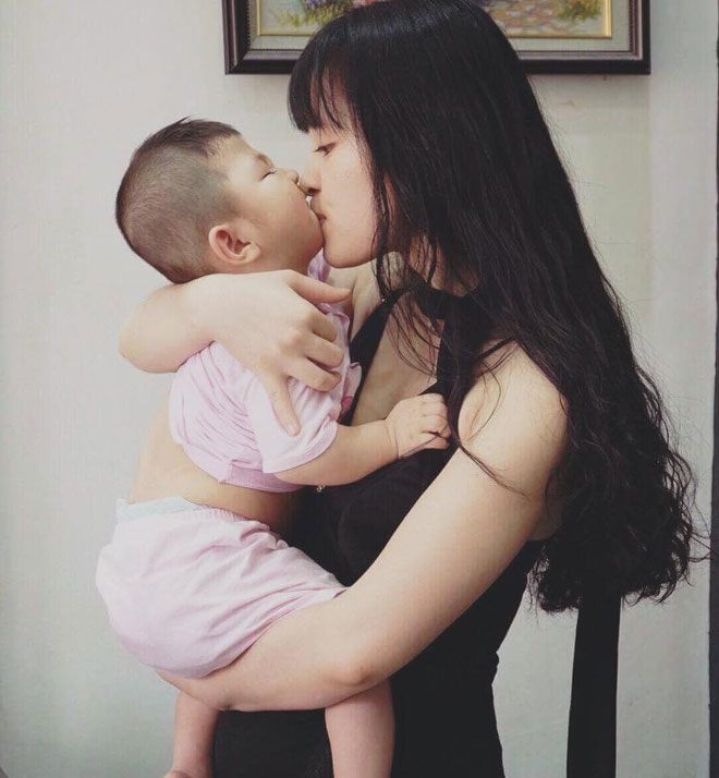 Sau 5 năm được tiểu thư 9X nuôi, bé Lào Cai suy dinh dưỡng giờ xinh xắn, phản xạ tốt