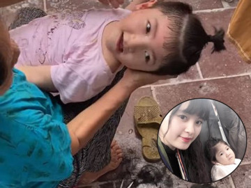 Sau 5 năm được tiểu thư 9X nuôi, bé Lào Cai suy dinh dưỡng giờ xinh xắn, phản xạ tốt