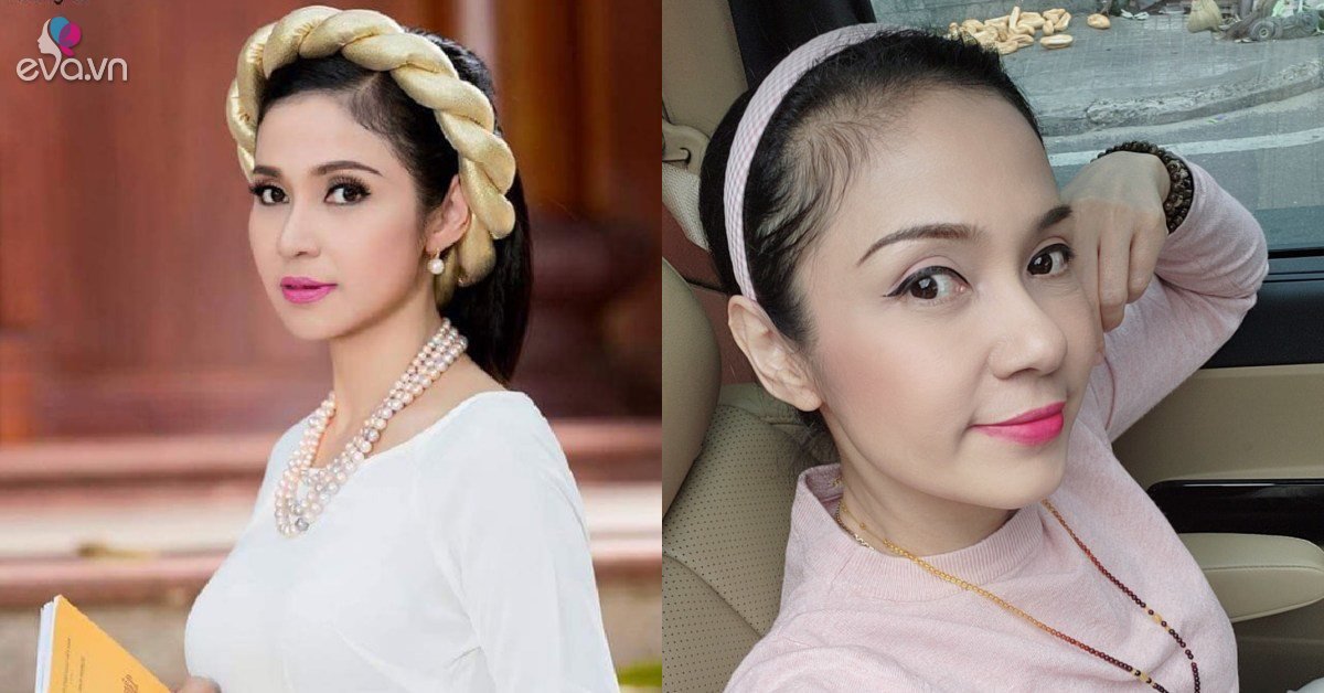 Is it true that Tay Do Viet Trinh’s beauty rumors had a stroke?  -Star