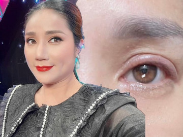 Bà mối Cát Tường gặp nạn làm đẹp, chị em không cẩn thận cũng dễ mắc phải