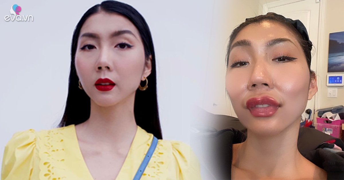 Secretly after the divorce, Ngoc Quyen suddenly posted a photo with an unrecognizable deformed face