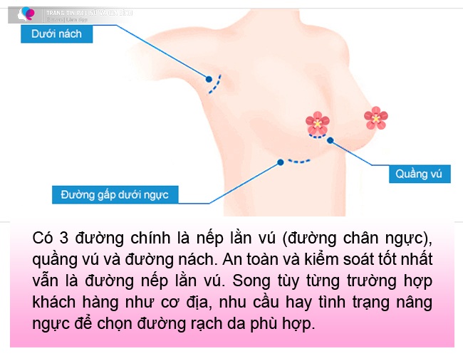 Đi nâng ngực, gái xinh amp;#34;khóc thétamp;#34; vì đường rạch nách xấu, sẹo dài nửa bàn tay - 5