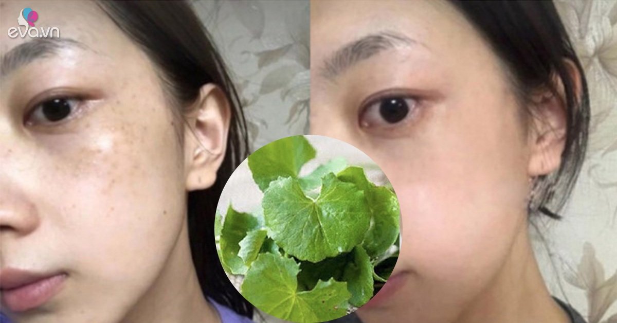 Buy 5 thousand centella asiatica for beauty, weight loss without brake, smooth skin