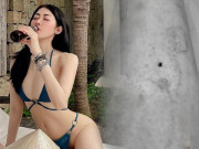Làm đẹp - Bế tắc vì di chứng thẩm mỹ, Hot girl Người ấy là ai trở lại ngoạn mục