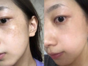Làm đẹp - Mua 5 ngàn rau má về làm đẹp, cân nặng giảm không phanh, da dẻ nhẵn thín