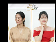 Làm đẹp mỗi ngày - Tái sinh đa tầng đồng hành cùng bạn trên chặng đường làm đẹp chiến thắng thời gian và tuổi tác